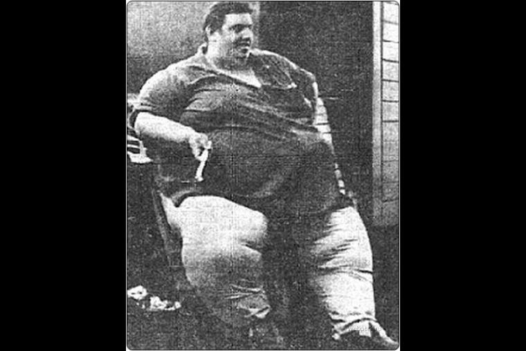 Las 5 personas más obesas de la historia