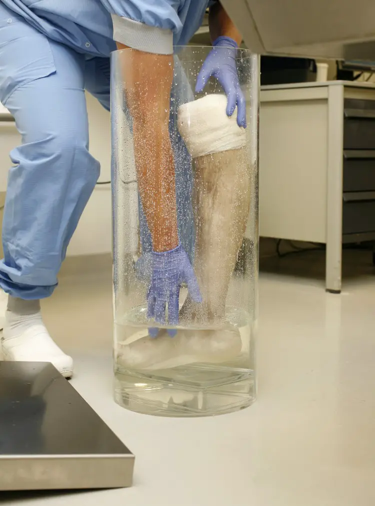 Heres-Leo-Bontens-Amputated-Leg-Being-Transfered-Into-the-Cylindrical-Lamp-Base-750x1012