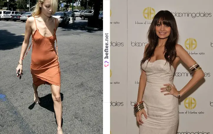 before-after-nicole-richie-anorexic-and-healthy-by-rebeca