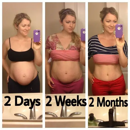 body-after-baby8