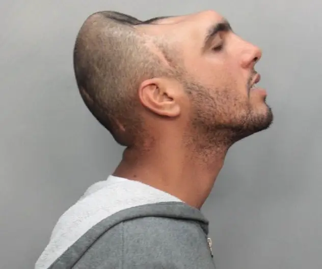 Man With Half a Head arrested