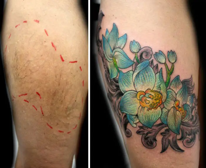 tatuaje-sobre-cicatrices-1