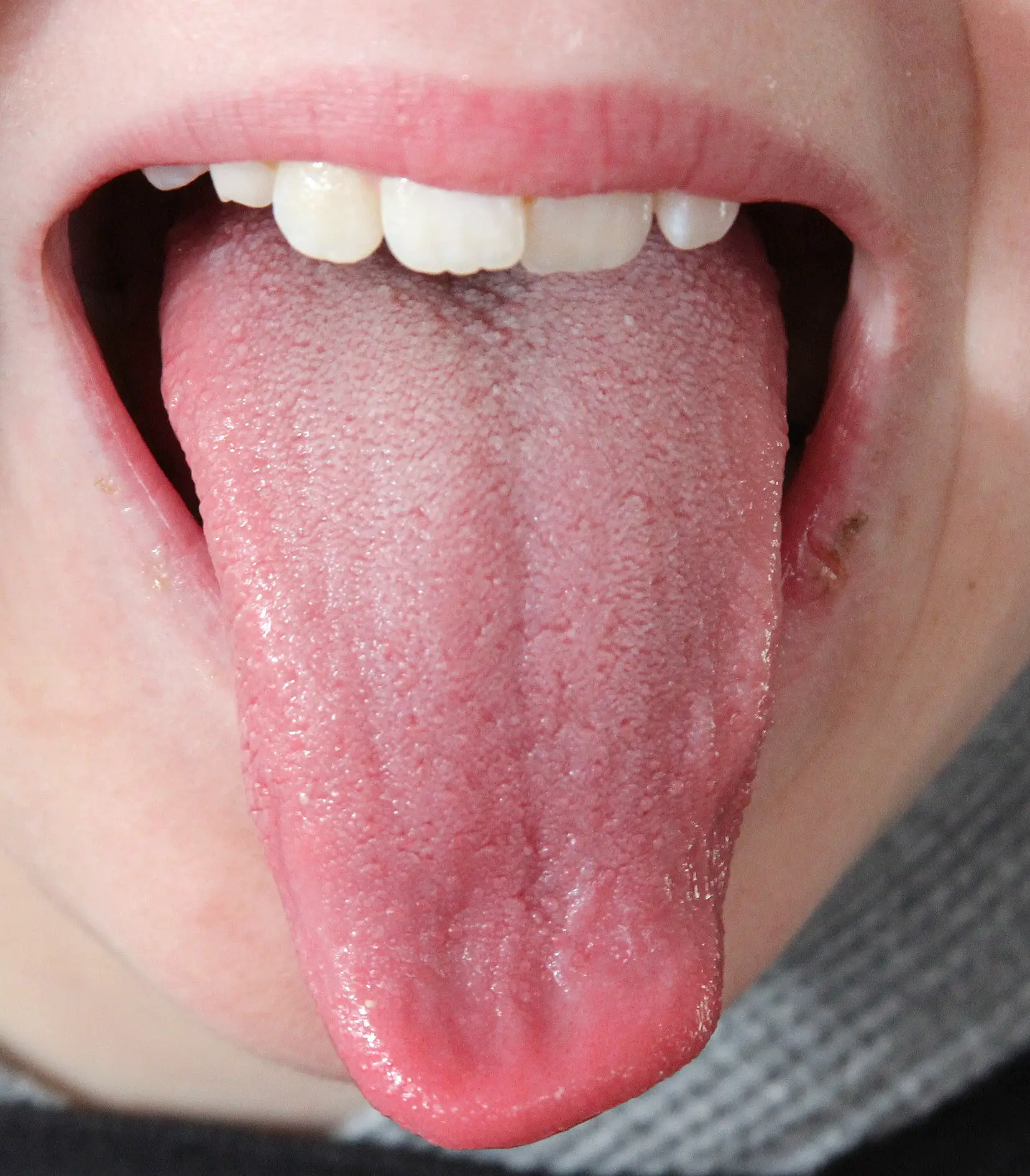 tongue-2a
