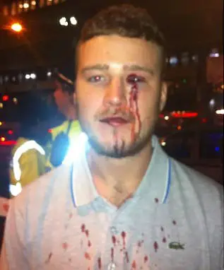 Justin Lloyd attacked by Shadiya Omar in a Manchester bar