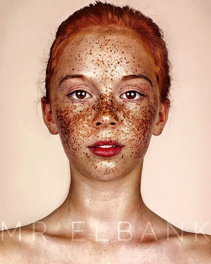 freckles-portrait-photography-brock-elbank-105__700