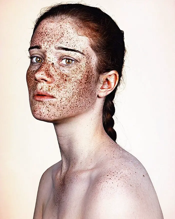 freckles-portrait-photography-brock-elbank-136__700