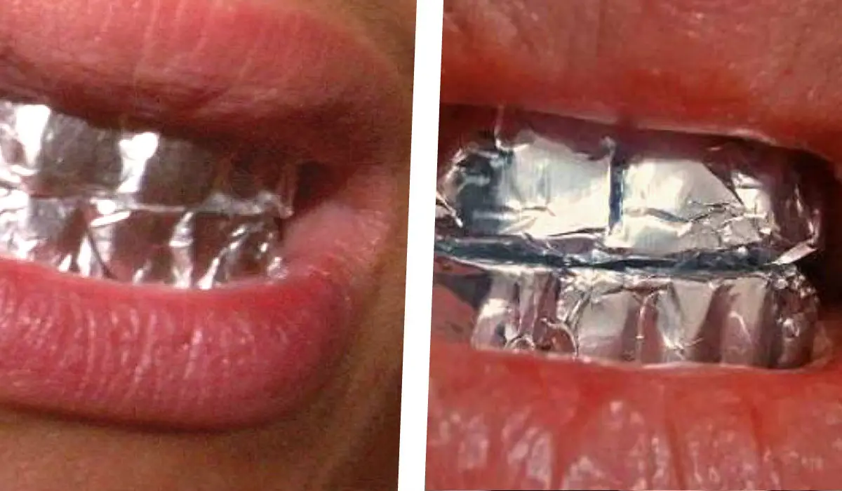 atlántico Estación Cumbre Esto es lo que pasa cuando envuelves tus dientes en papel aluminio. ¡Es  instantáneo! | Difundir.ORG