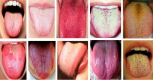 Mira lo que tu lengua puede revelar acerca de tu salud ¡INTERESANTE