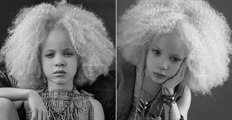 Ava-Clarke-la-niña-albina-de-raza-negra-que-cautiva-en-el-mundo-de-la-moda-portada