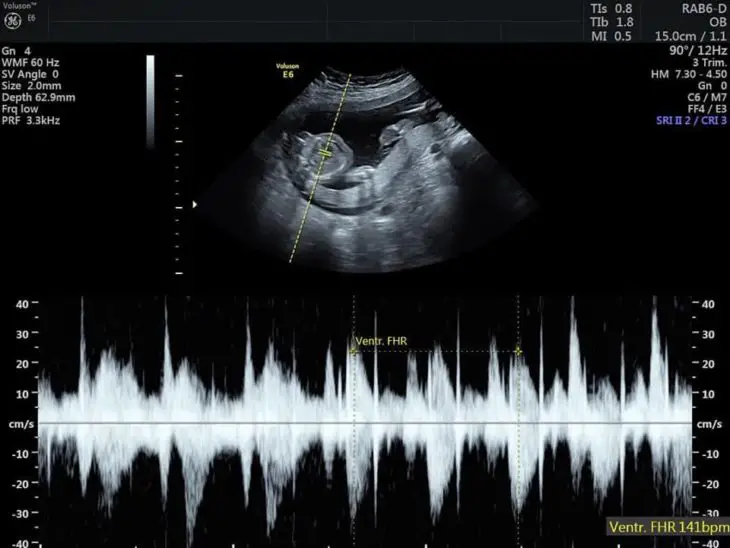 Madre-donará-organos-bebé-4-730x548