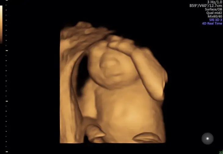 Madre-donará-organos-bebé-5-730x504