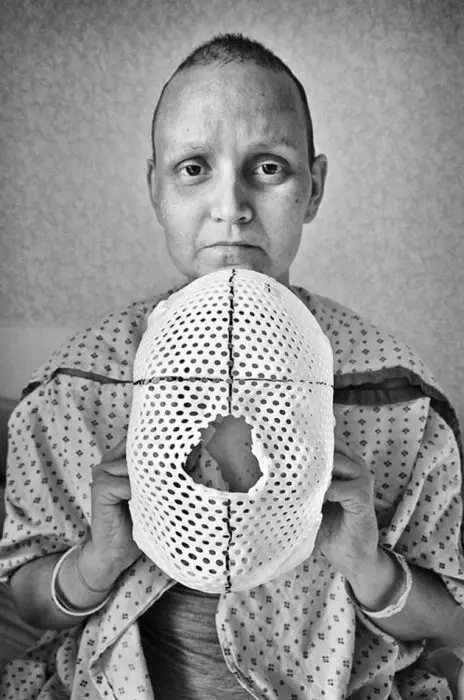fotografo-retrata-a-su-esposa-con-cancer-hasta-que-muere-6-464x700