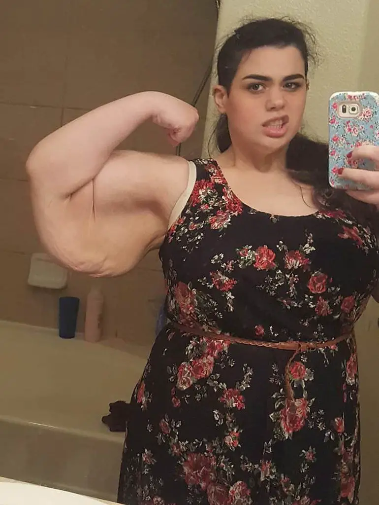 Conoce a Amber Rachdi Ella perdió más de 180 kg en sólo dos años y
