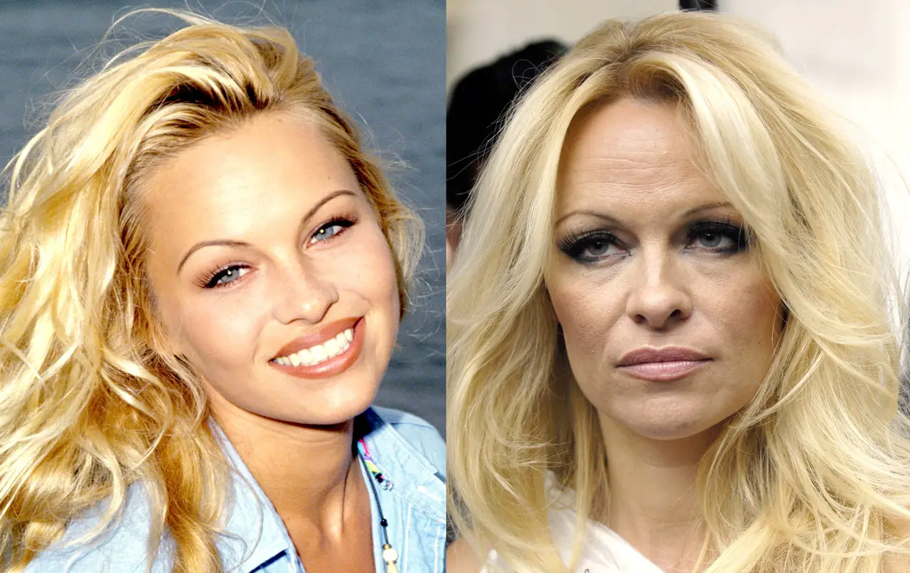 3. Pamela Anderson.