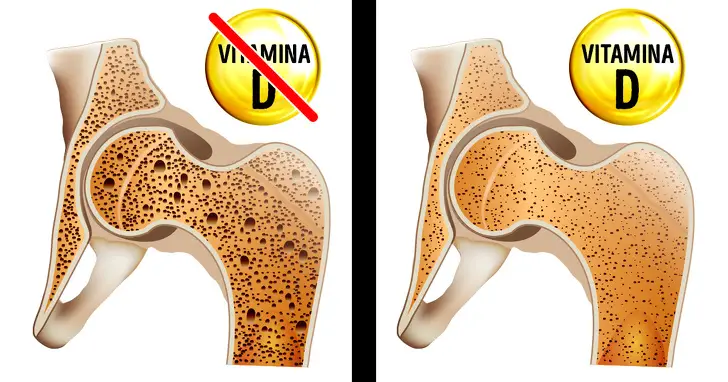 8 Señales De Que Tu Cuerpo Necesita Desesperadamente Más Vitamina D Difundirorg 7953