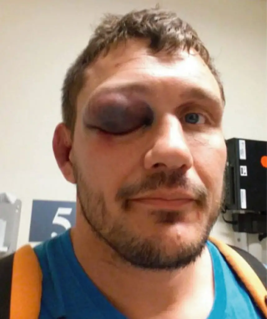 Despertó sin memoria, con el rostro golpeado y una nota de su mujer que