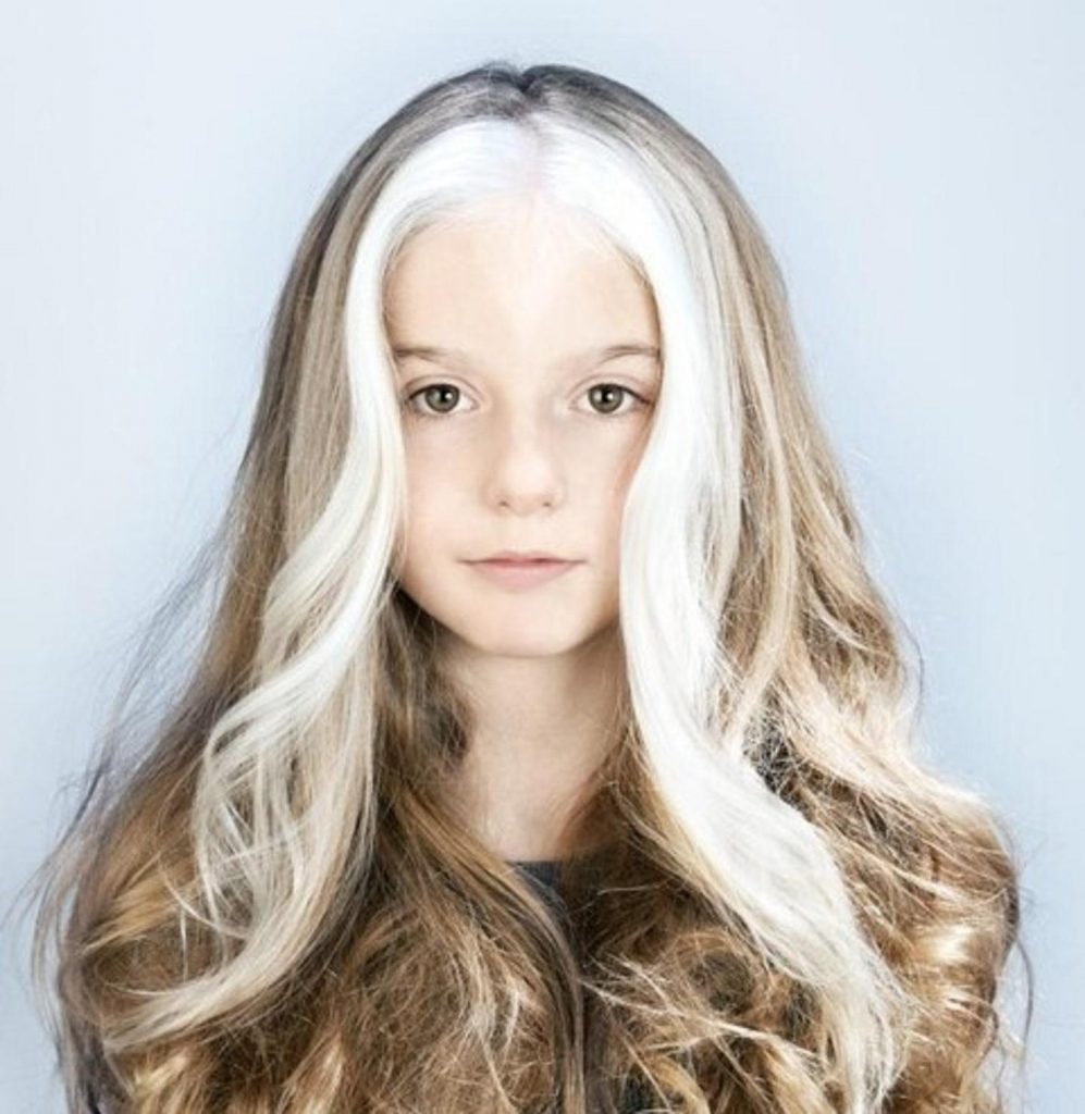 16 Personas que ganaron la lotería genética